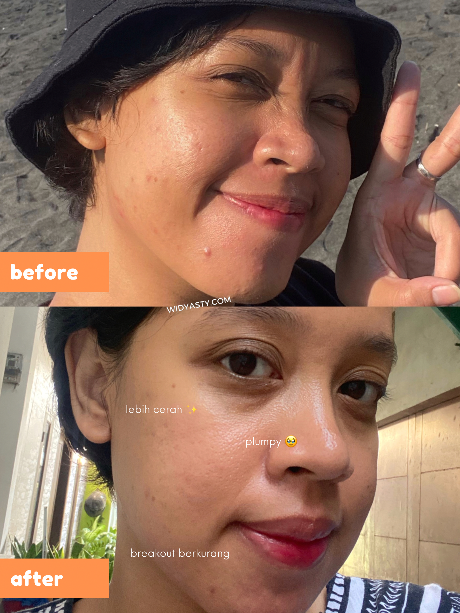 https://widyasty.com